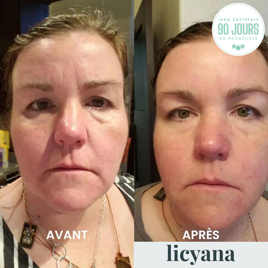 Crème Anti Cernes et Rides Instantanée