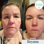 Crème Anti Cernes et Rides Instantanée